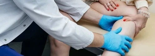 Сосудистые звёздочки — это первая стадия варикоза или просто косметика?